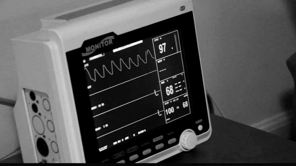 A medical monitor displaying vital signs with green waveforms on a dark screen.
